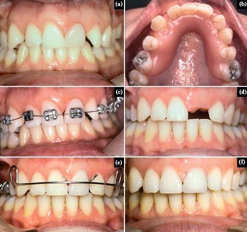 Little Smile Dental Clinic Ramanattukara