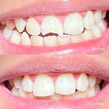 Little Smile Dental Clinic Ramanattukara