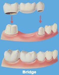 Little Smile Dental Clinic Ramanattukara