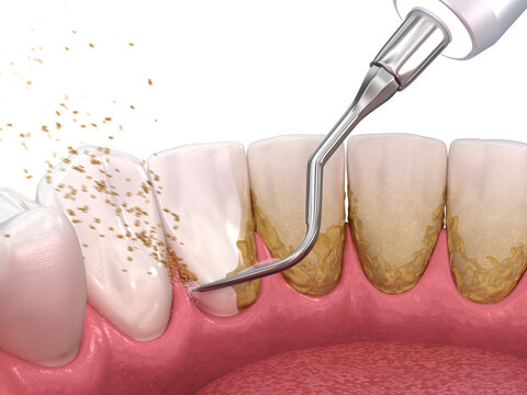 Little Smile Dental Clinic Ramanattukara